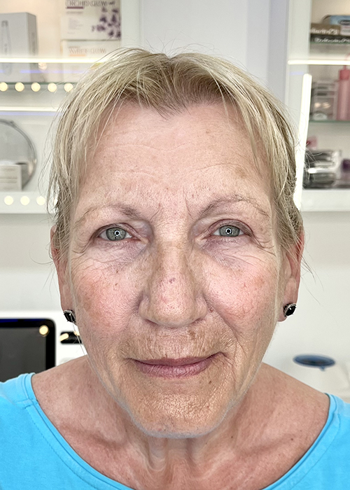cliente-permanent-make-up-gran-canaria-before-and-after-5aa