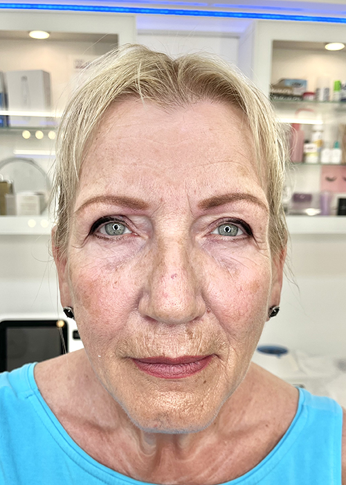 cliente-permanent-make-up-gran-canaria-before-and-after-5bb